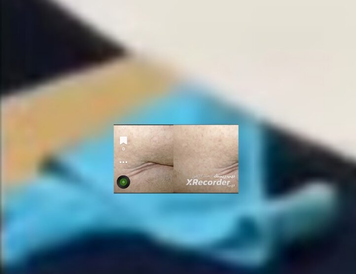 Bioncaseven